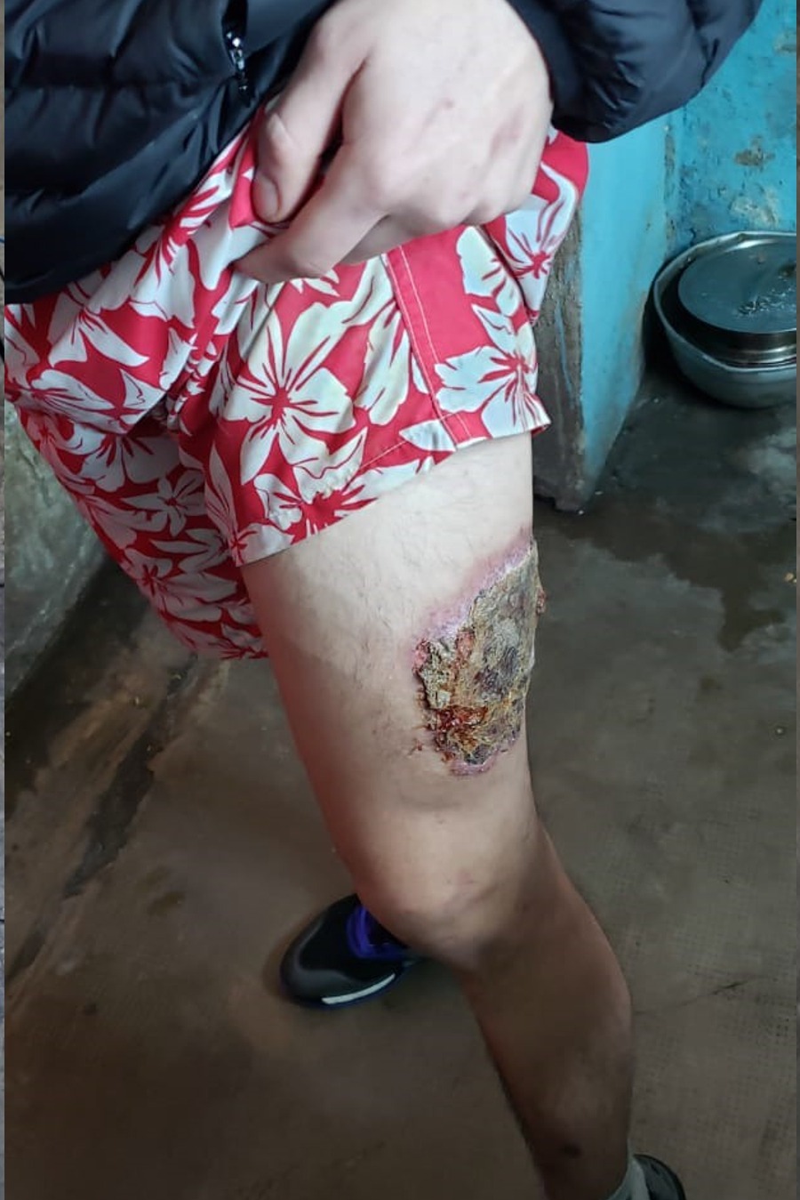 situación del Penal 3